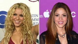 Shakira Before and After Plastic Surgery Journey